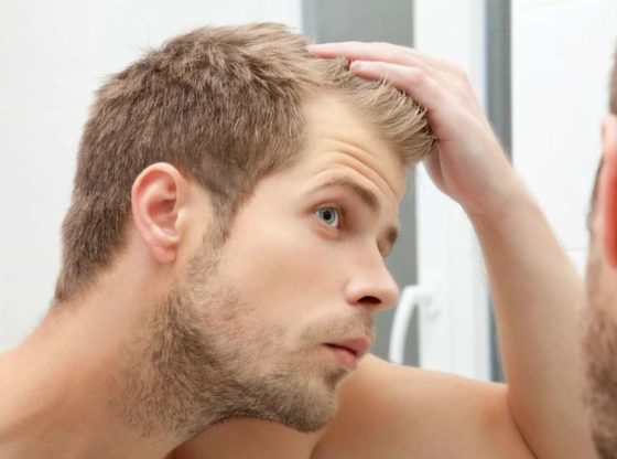 PRP And Your Hair Restoration Therapy